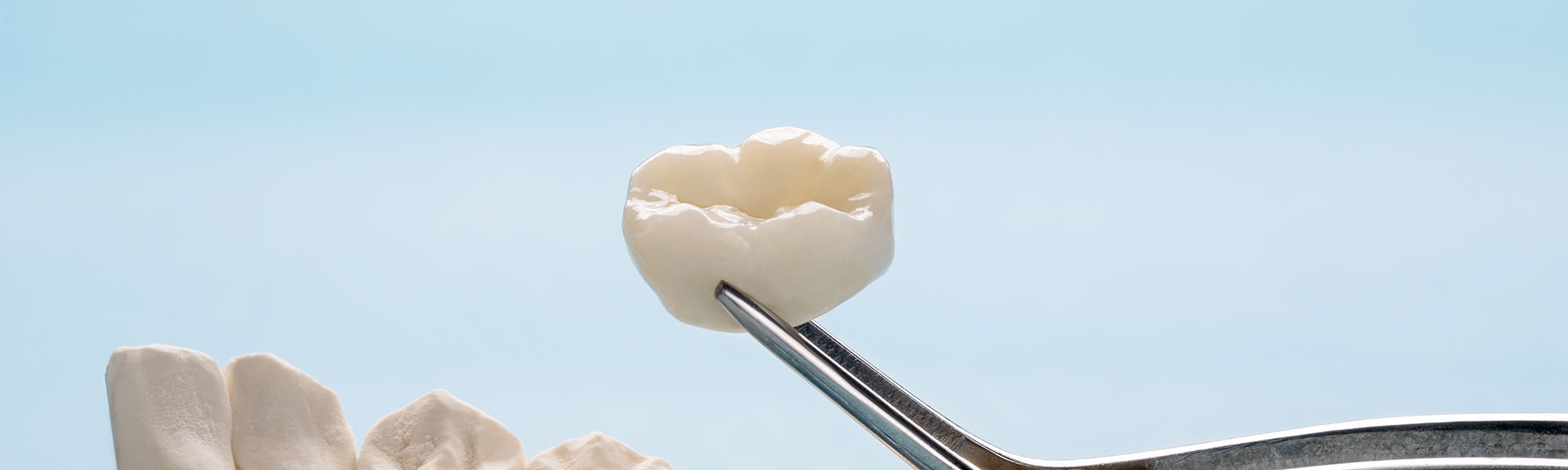 Porcelain Crowns Long Beach CA