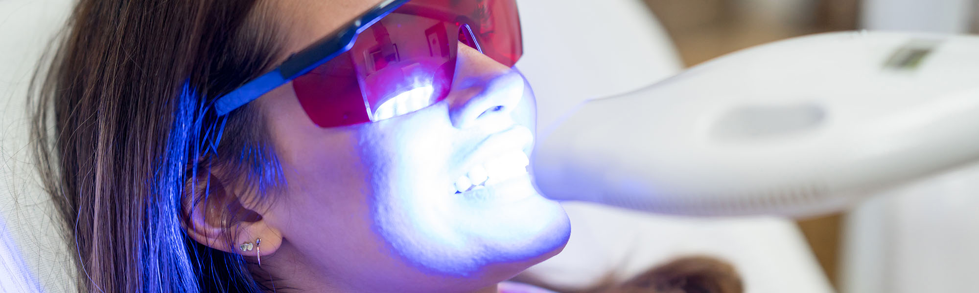 Teeth Whitening Long Beach CA