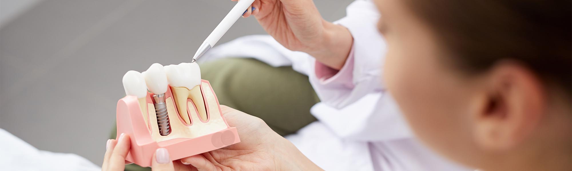 Dental Implants Long Beach CA